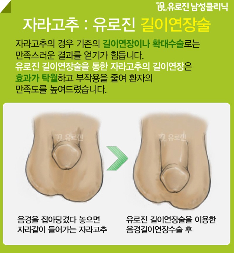 자라고추 때문에 이렇게 불편해 : 네이버 블로그