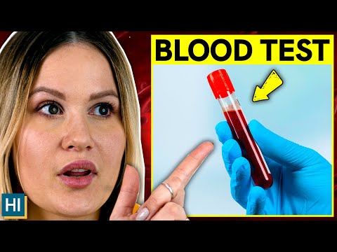 Fasting for a Blood Test: Dos and Dont’s