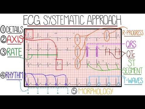 ECG Interpretation Made Easy (Learn How to Interpret an ECG in 13 Minutes)