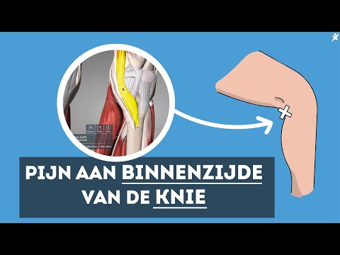 Pijn binnenkant knie? Ontdek de oplossing