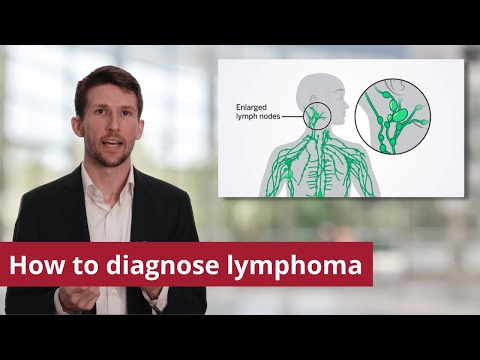 Lymphoma Diagnosis