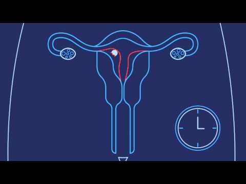 How Do You Get Pregnant? | Planned Parenthood Video