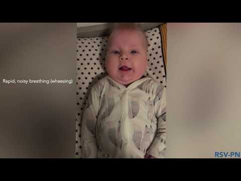 Symptoms severe Bronchiolitis RSV infection | RSV Awareness Week 2020