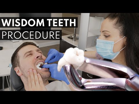 Wisdom Teeth Extraction PROCEDURE | How to Prepare, What to Expect & Cost