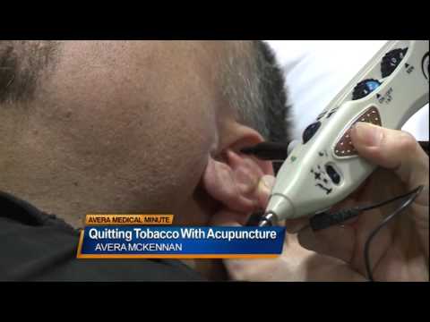 Using Acupuncture to Finally Quit Tobacco - Medical Minute