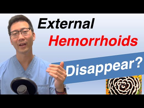 Can External hemorrhoids go away on their own? Does treatment matter?