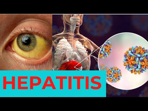 HEPATITIS