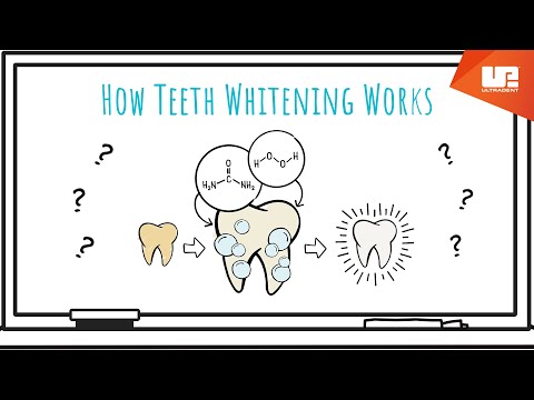 How Teeth Whitening Works